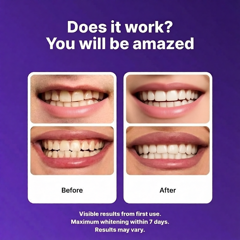Purple Teeth Whitening Strips — Gen 2